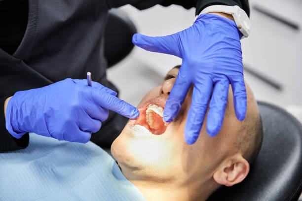 Best Emergency Wisdom Teeth Removal in Garden Acres, CA