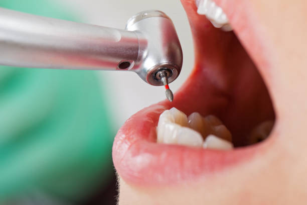 Best Emergency Orthodontic Repairs in Garden Acres, CA